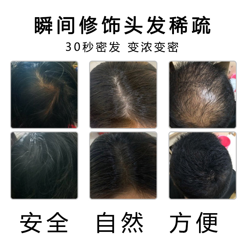 toppik密发增发纤维粉喷雾头发稀少神器填充浓密补发假发际线