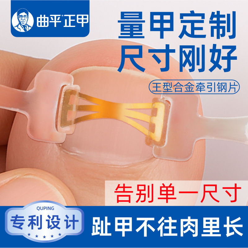曲平正甲甲沟嵌甲指甲矫正器炎正甲贴片医生脚趾甲盖扎肉足科专用