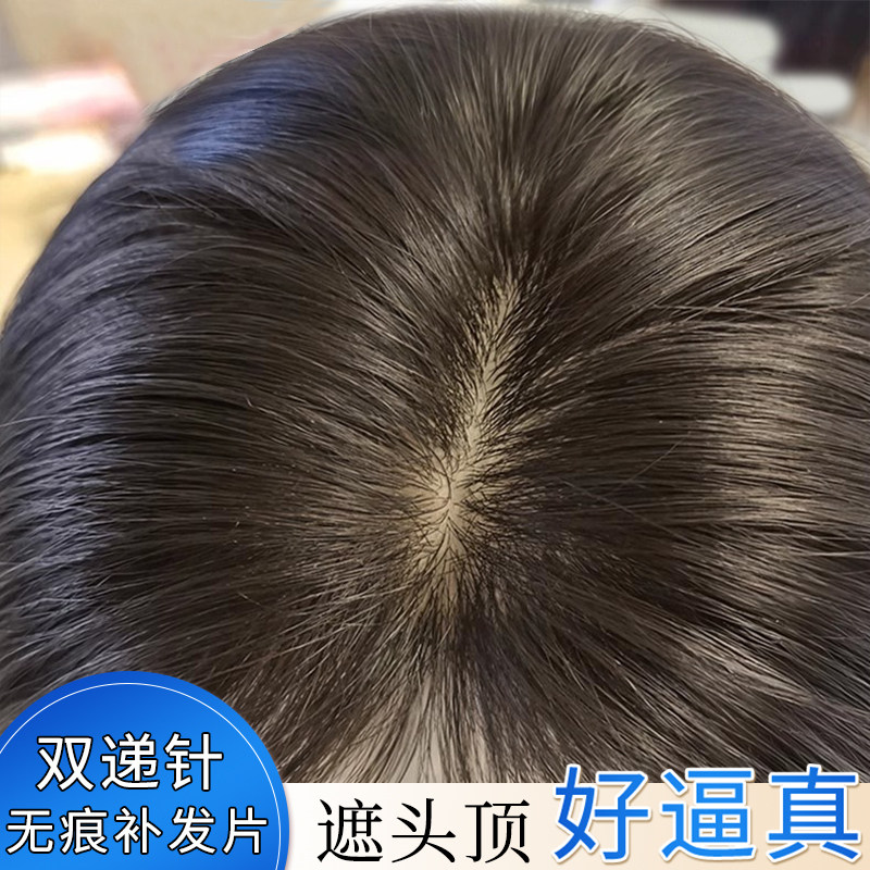 不用戴发网假发片女头顶补发双递针E真发增发量轻薄遮白发蓬松头