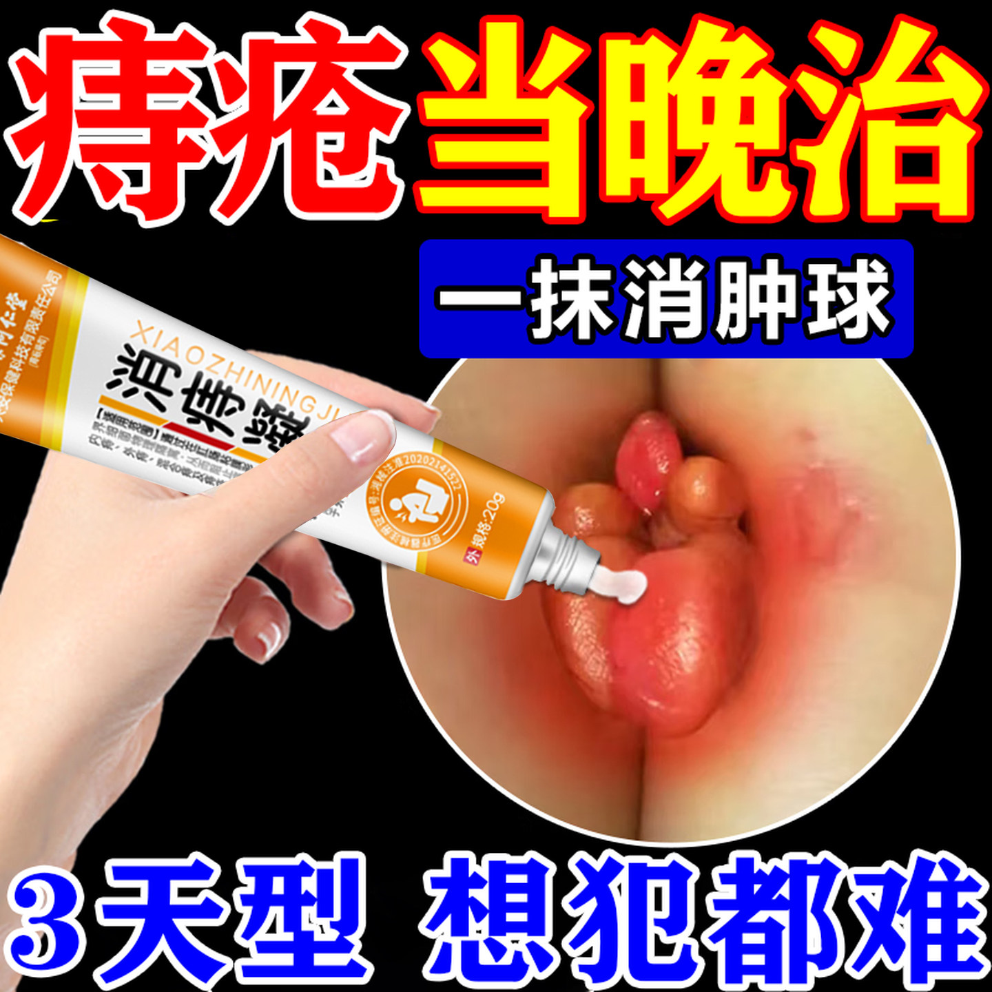 华医郎痔疮凝胶痔疮药膏排行榜第一名根消肉球痔断正品官方旗舰店