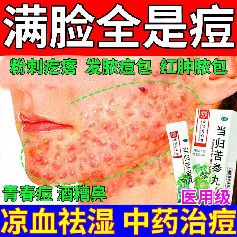 当归苦参丸北京同仁堂 祛痘药内服痤疮口服药粉刺脓包消炎药祛湿