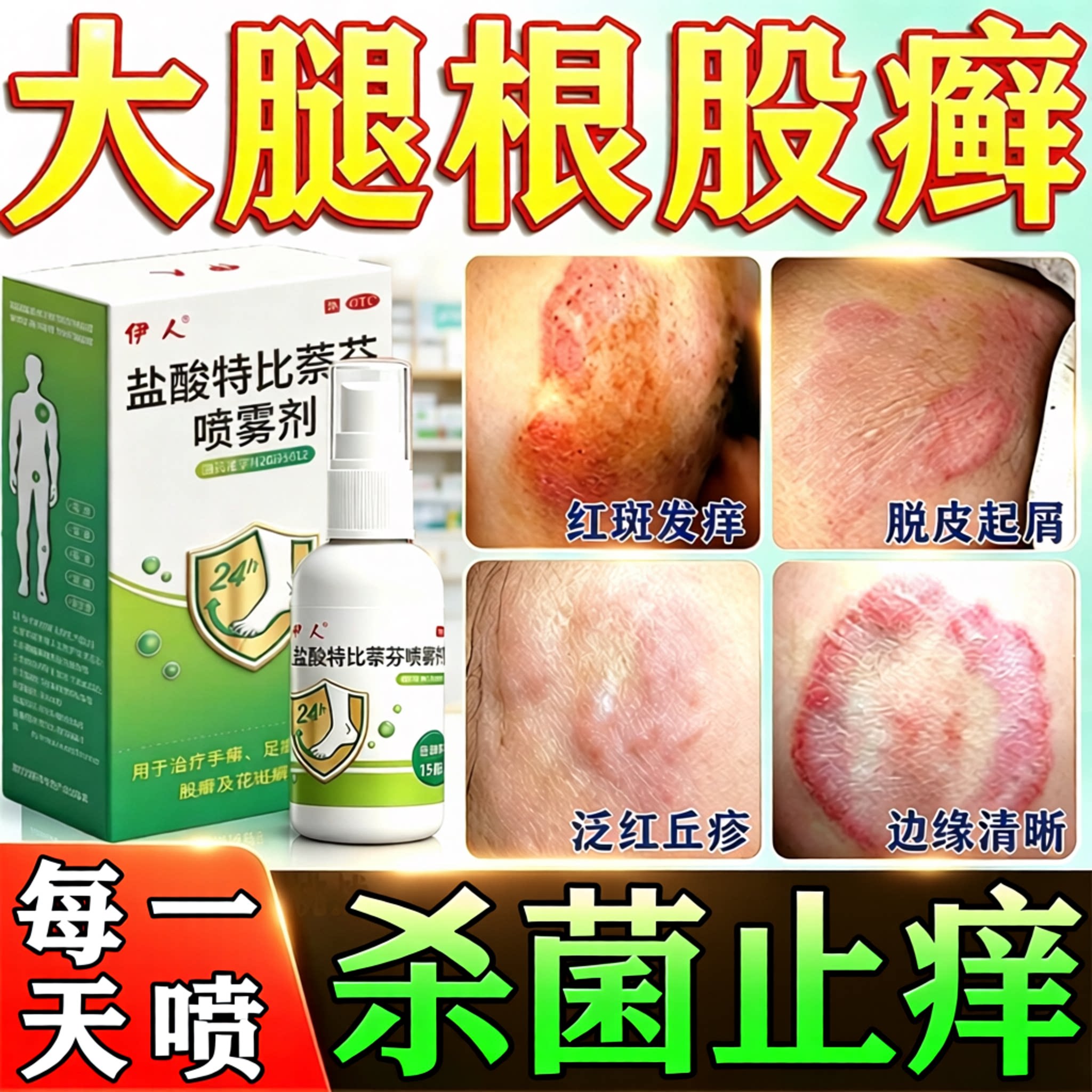 [恒玉佳]盐酸特比萘芬喷雾剂1%*15ml*1瓶/盒