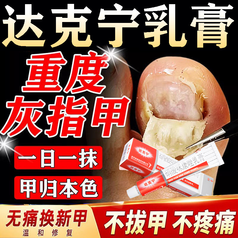 [达克宁]硝酸咪康唑乳膏2%*20g*1支/盒