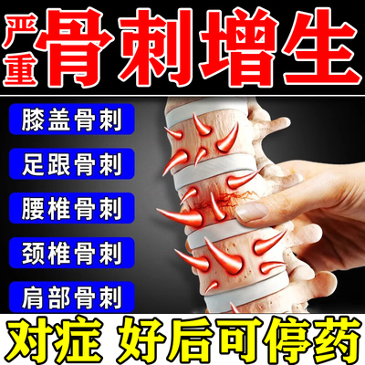 骨刺贴膏去特根效药骨刺去足根跟痛筋膜炎脚后疼骨质增生专用药膏