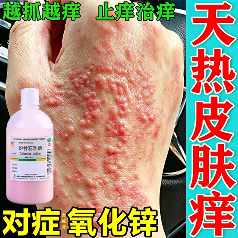 [信龙]炉甘石洗剂5%5%15%*100ml/瓶