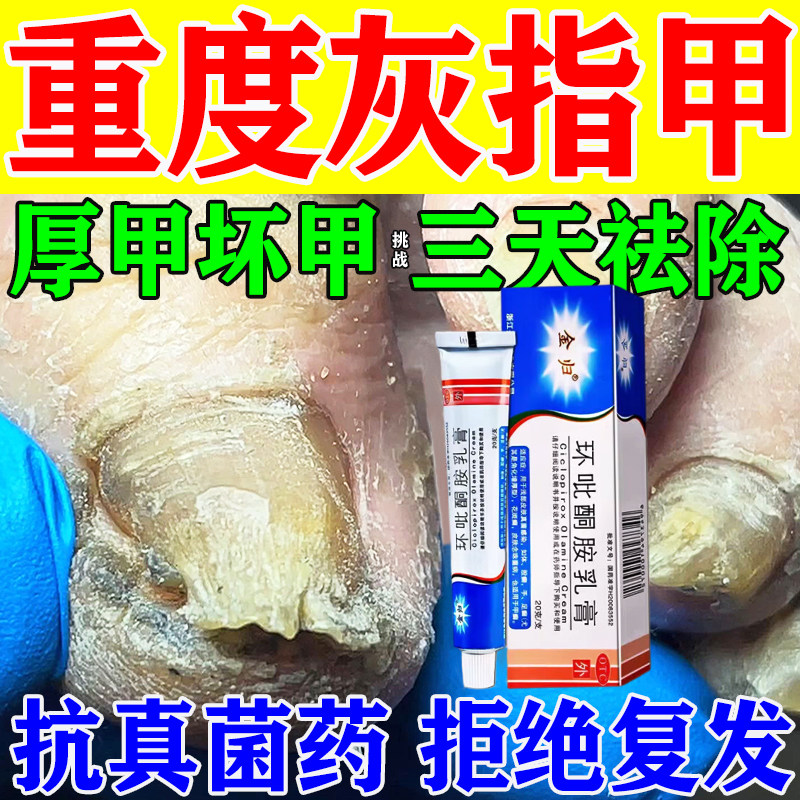 【双吉】环吡酮胺乳膏1%*20g*1支/盒