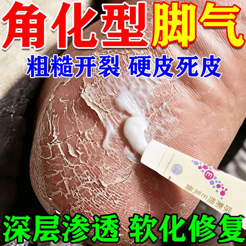 尿素维e乳膏正品脚后跟干裂真菌感染角化型脚气专用药乳膏