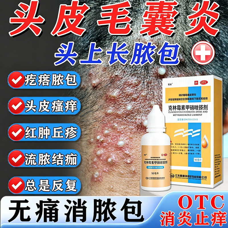 克林霉素甲硝唑搽剂官方旗舰店治疗头皮毛囊炎专用特新效期药膏