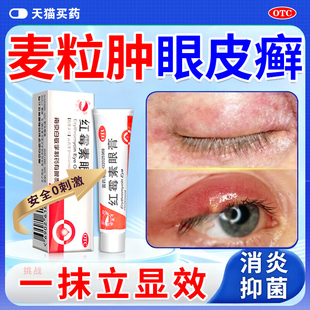 红霉素眼膏麦粒肿特新效药眼贴针眼修复眼皮肉粒眼周油脂粒疙瘩药