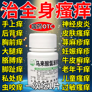 全身瘙痒吃什么药扑尔敏过敏药100片皮肤过敏口服药止痒药S