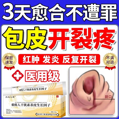 包皮炎症专用开裂口发炎真菌感染
