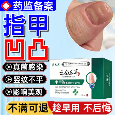 指甲凹凸不平修复液真菌感染甲面竖纹受损不平养甲床分离生长液WW