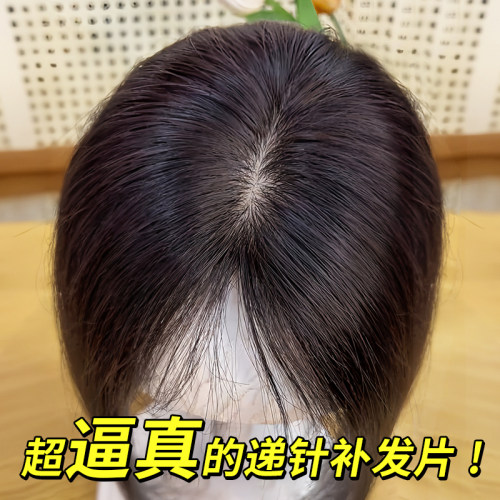 假发女片头顶补发增发量蓬u松全真人发遮白发轻薄款自然刘海假发