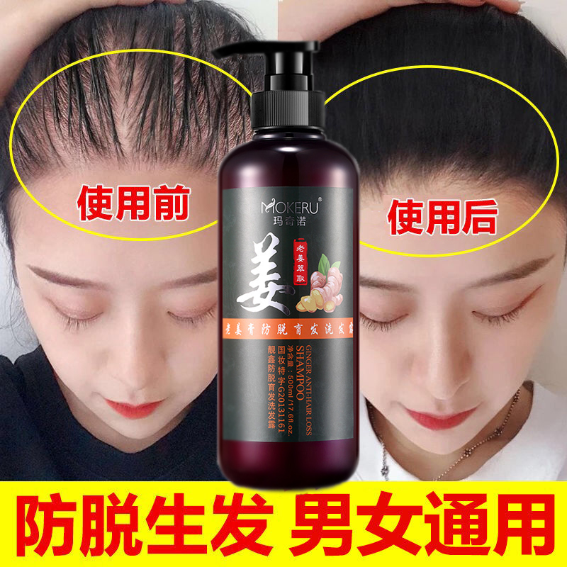 束发防脱发洗发水生发增发密v防掉头发生姜脱发严重女士男专用产
