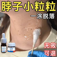 日本點(diǎn)痣膏無痕正品藥膏水點(diǎn)痣筆臉部專用去非藥水液美容院旗艦店