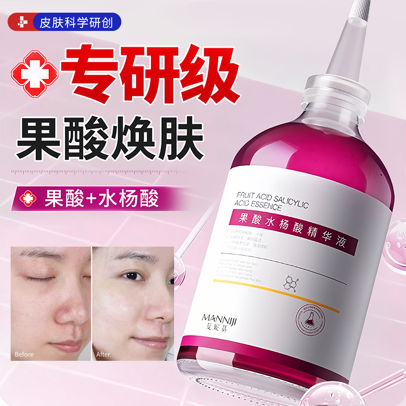 果酸水杨酸精华液收缩毛孔粗大修复非医用控油去黑头粉刺闭口痘印