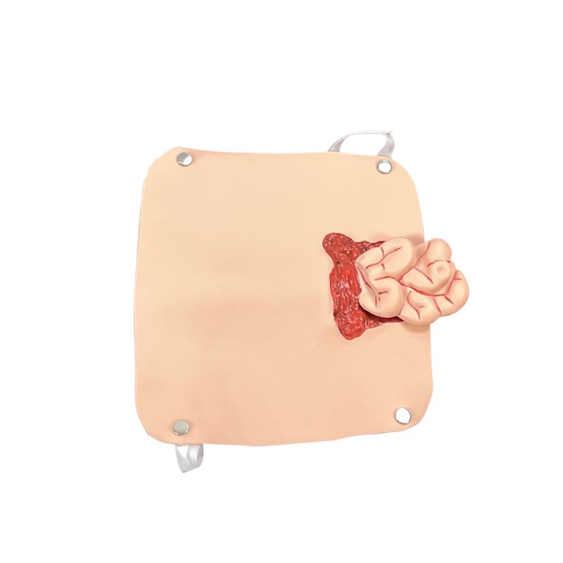 泰贵医学腹部小肠突出创伤模块捆绑式肠外露模拟训练模块