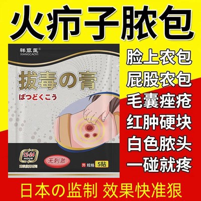 拔毒膏拔毒贴火疖子脓包疙瘩肿软膏拔脓贴吸脓头面部脖子背屁股