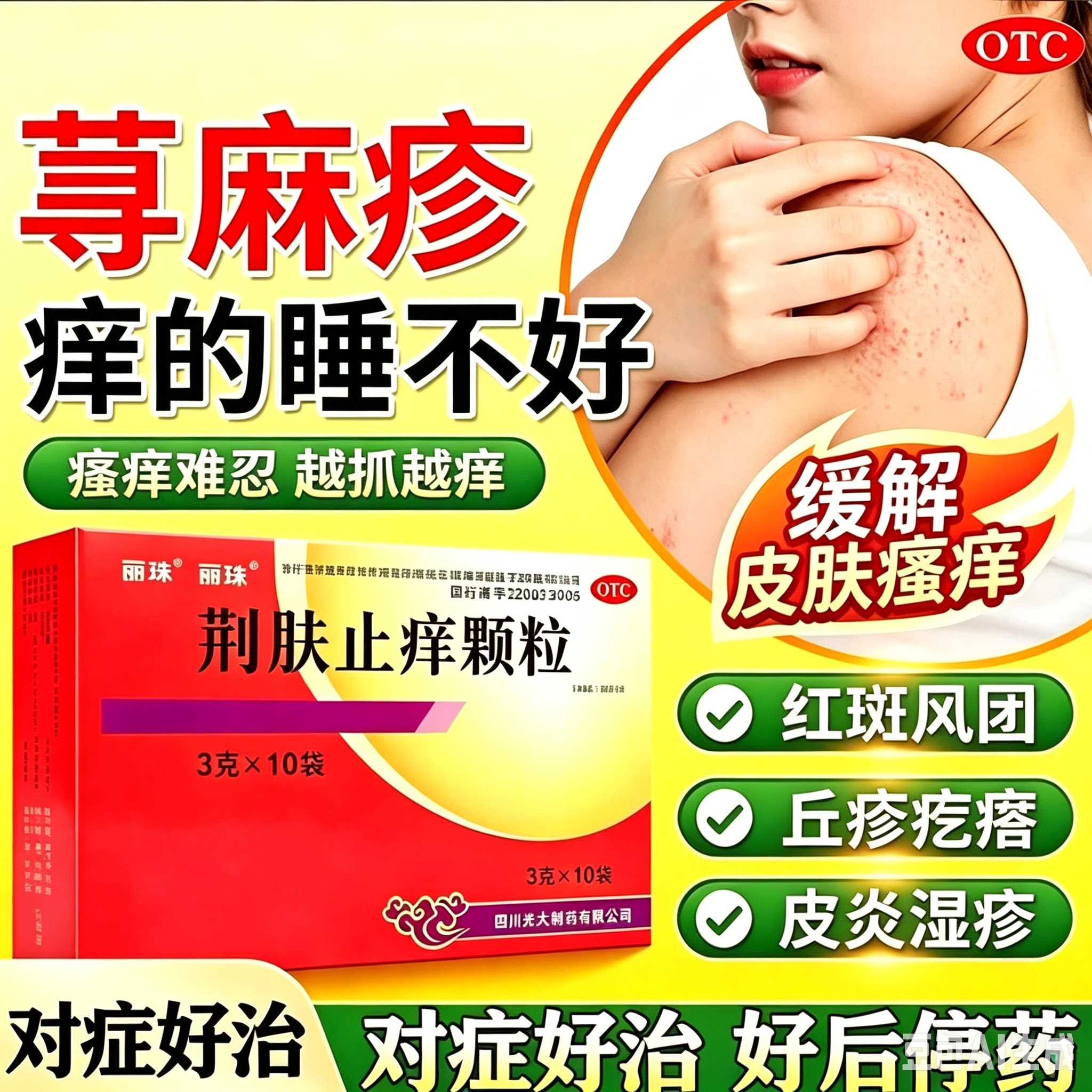 成人儿童可用皮肤瘙痒皮炎湿疹荨麻疹祛风除湿专用药祛风除湿止痒