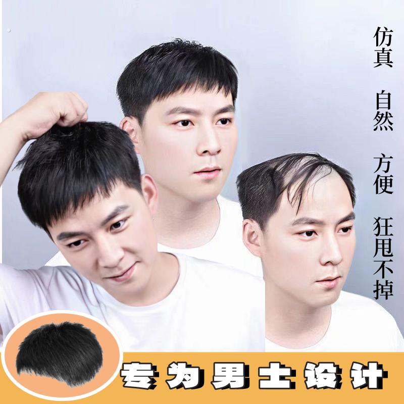 寸头假发躲检查男士补发片神器隐形补发块帅气无痕地中海秃顶发际