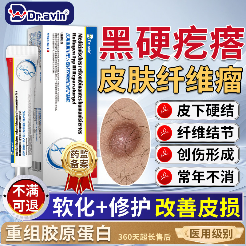 医用皮肤纤维瘤去除药膏皮下硬块疙瘩结节脂肪瘤消瘤肿硬块神器SE
