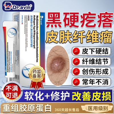 【Dr.avin重组型】皮肤纤维瘤