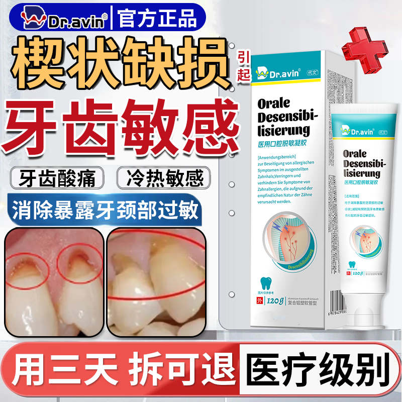 牙根牙釉质腐蚀牙齿烂洞修复液楔状缺损修补敏感修护凝胶非牙膏CS