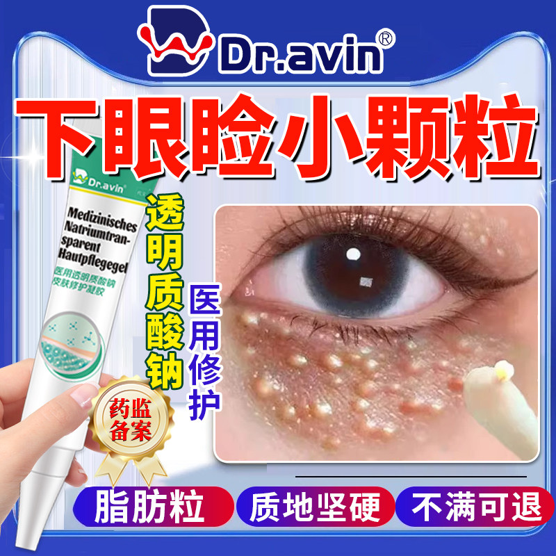 眼部脂肪粒去除神器眼睛下面小颗粒汗管瘤闭口膏药贴专用旗舰店SE