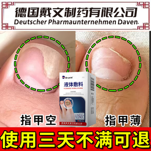 Dravin肉床分离引起空指甲营养液受损再真菌感染生手指甲LJ