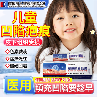 Dr.avin儿童凹陷性疤痕修复除疤膏生长因子指甲抓伤摔伤祛疤膏SE