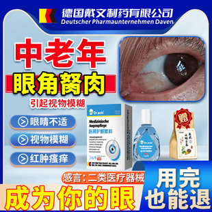 dr.avin去除眼睛胬肉可搭滴眼液眼角长翼状胬肉有异物感眼药水LJ