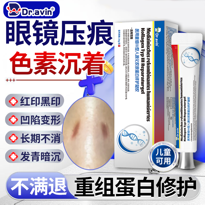 去儿童戴眼镜印鼻梁鼻托防压痕鼻贴修复色素沉着消除膏美白神器CS