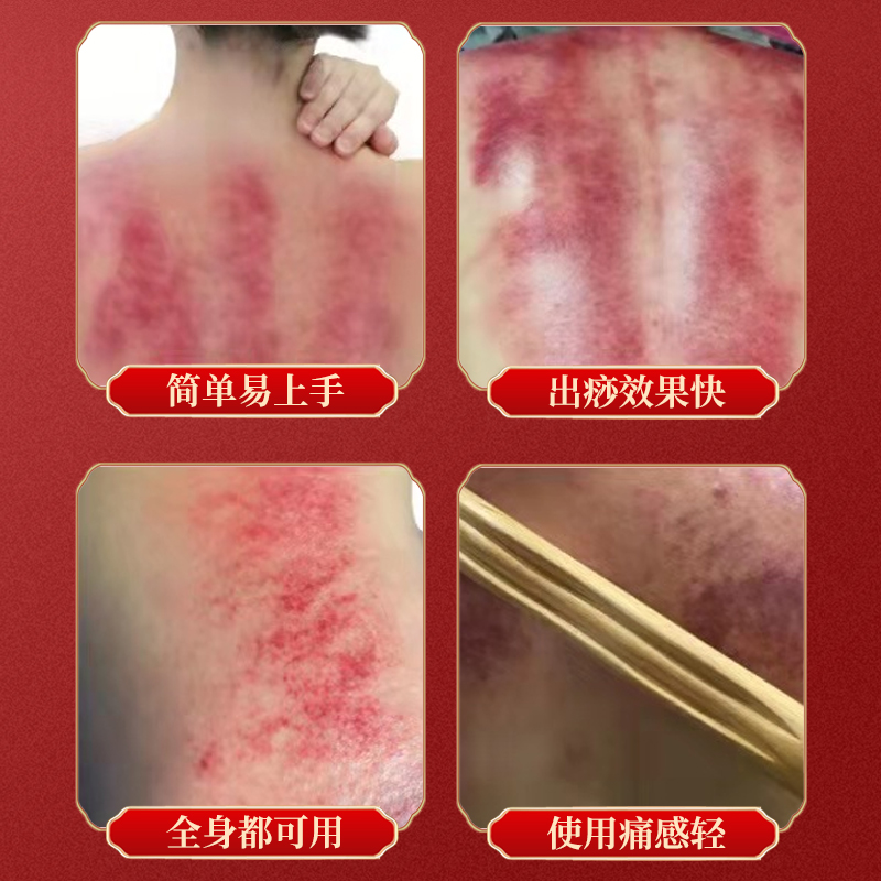 鸡翅木八珠赶筋棒全身通用刮痧按摩刮肚子赶筋经络疏通赶筋棍肩颈