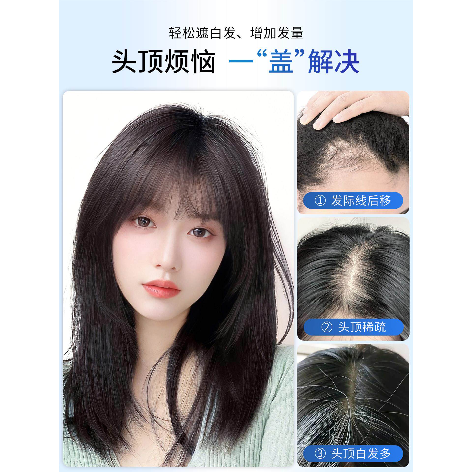 假发的妇女，真正，的发在头顶覆盖灰色的头发，薄和头无迹，修补