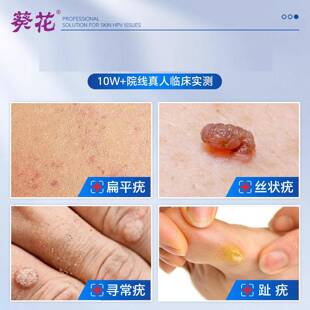 葵花医用抗HPV生CGP凝胶祛疣扁平肉疣瘊粒物软膏方旗舰官店正品8H