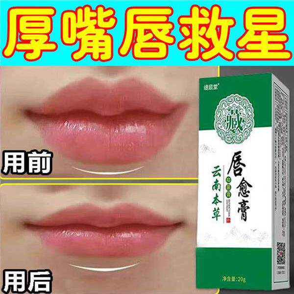 嘴唇变薄变小神器改善厚嘴巴瘦唇膏香肠嘴缩小周边唇角黑外翻药