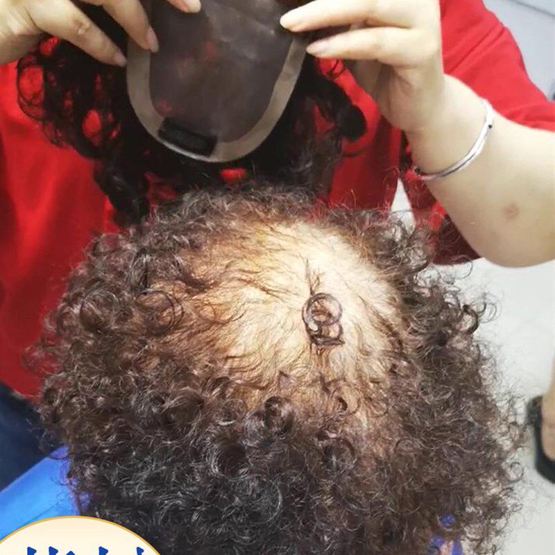 卷发假发片小卷补发块假发女短真发头顶补发片遮白U发自然刘海发