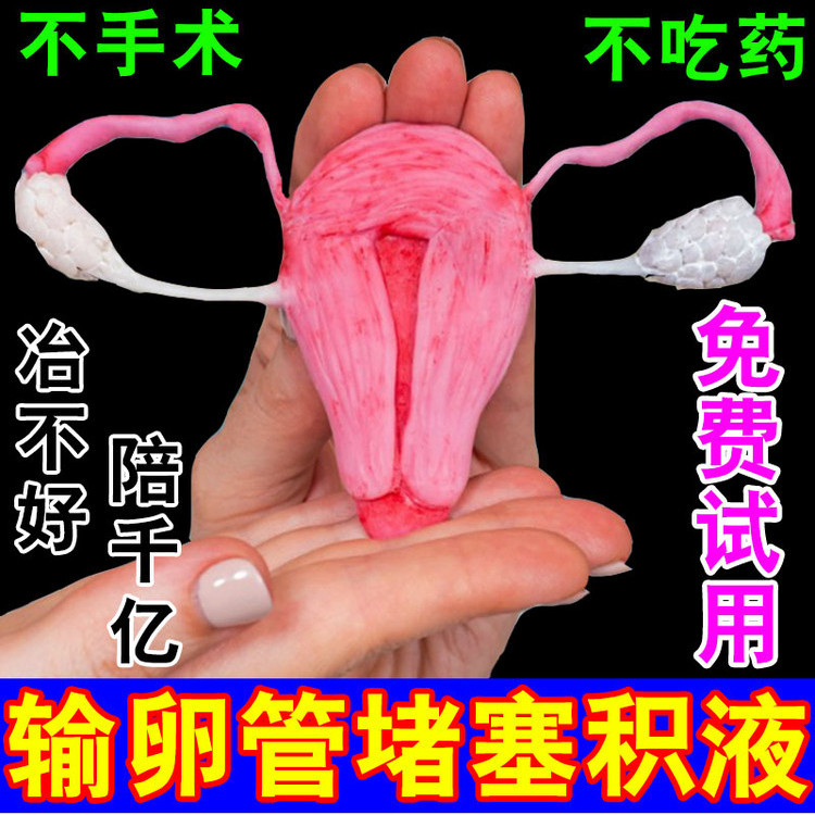 输卵|馆堵塞伞端黏连宫腔积液