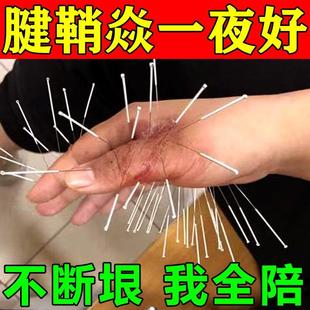 无需小针刀 专冶腱鞘焱 腱鞘手指大拇指关节手腕疼痛肿胀止痛贴