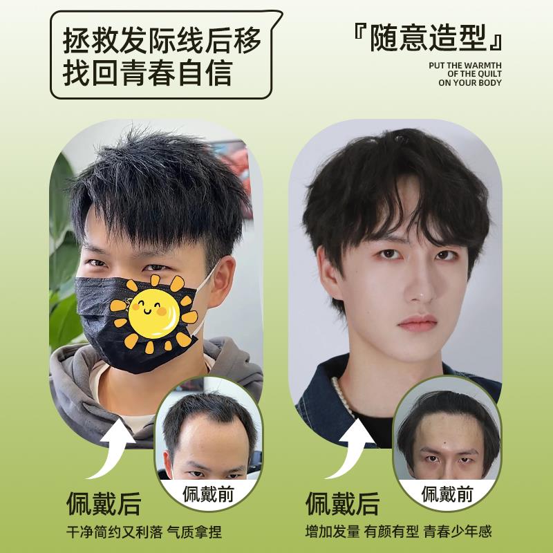 m形发际线假发贴男士假发前额隐形无痕男款鬓角全真发刘海补发片