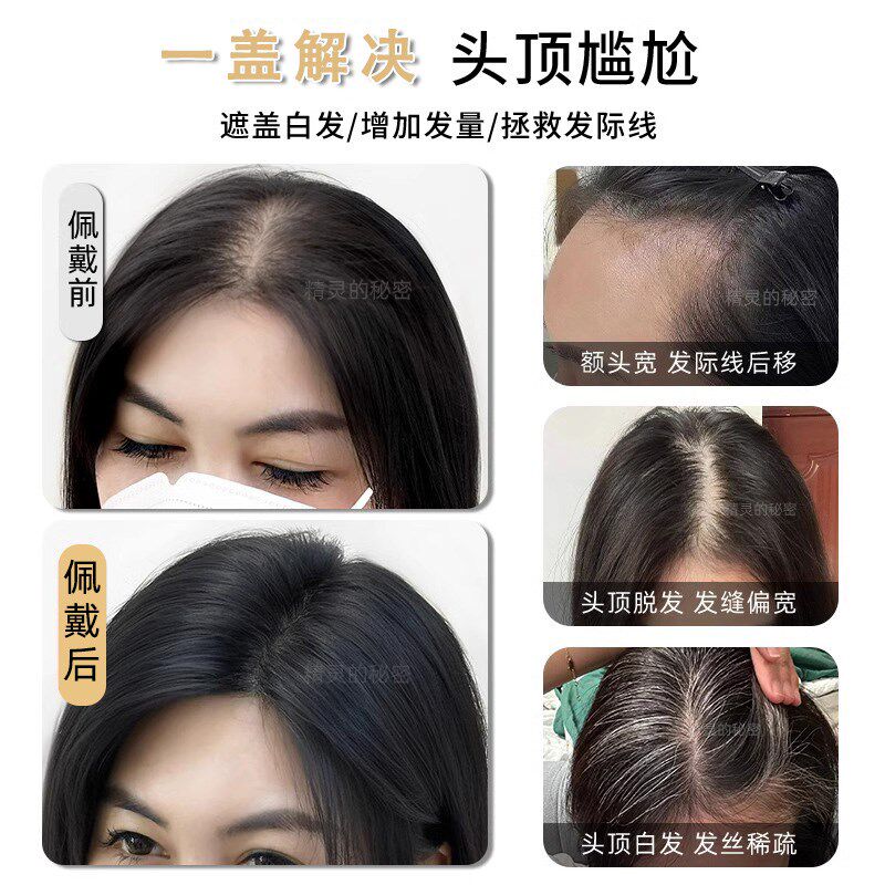 双递针假发片补发女头顶补发片真发蓬松遮白仿真头皮轻薄透气无痕