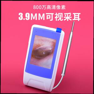 高清可视挖耳勺检测耳鼻喉内窥镜耳朵清洁扣耳勺采耳工具掏耳朵