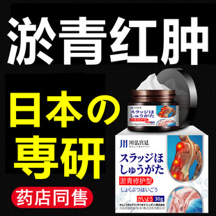 淤青膏快速消除乌青活化专消肿散去血淤除淤跌打成人儿童外用正品