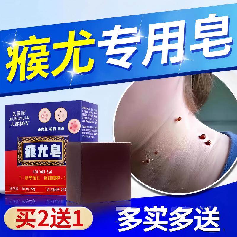 瘊疣专用皂丝状疣肉粒去除神器脖子上长小肉粒皮赘扁平疣面颈部