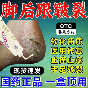 尿素维生素e乳膏医用型治脚裂脚后跟干裂起皮足跟开裂角化症专用