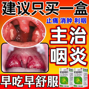 冬凌草片治咽喉炎慢性咽炎专用特新效根异物感除喉咙干痒痛肿中药