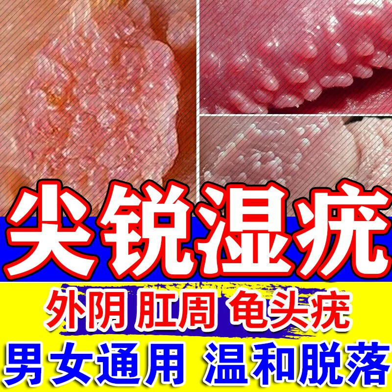 【福元】阿昔洛韦乳膏3%*10g*1支/盒