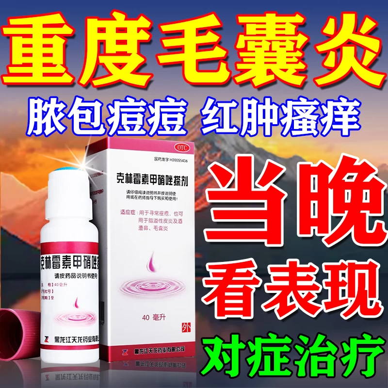 【天龙】克林霉素甲硝唑搽剂0.8%1%*40ml*1瓶/盒