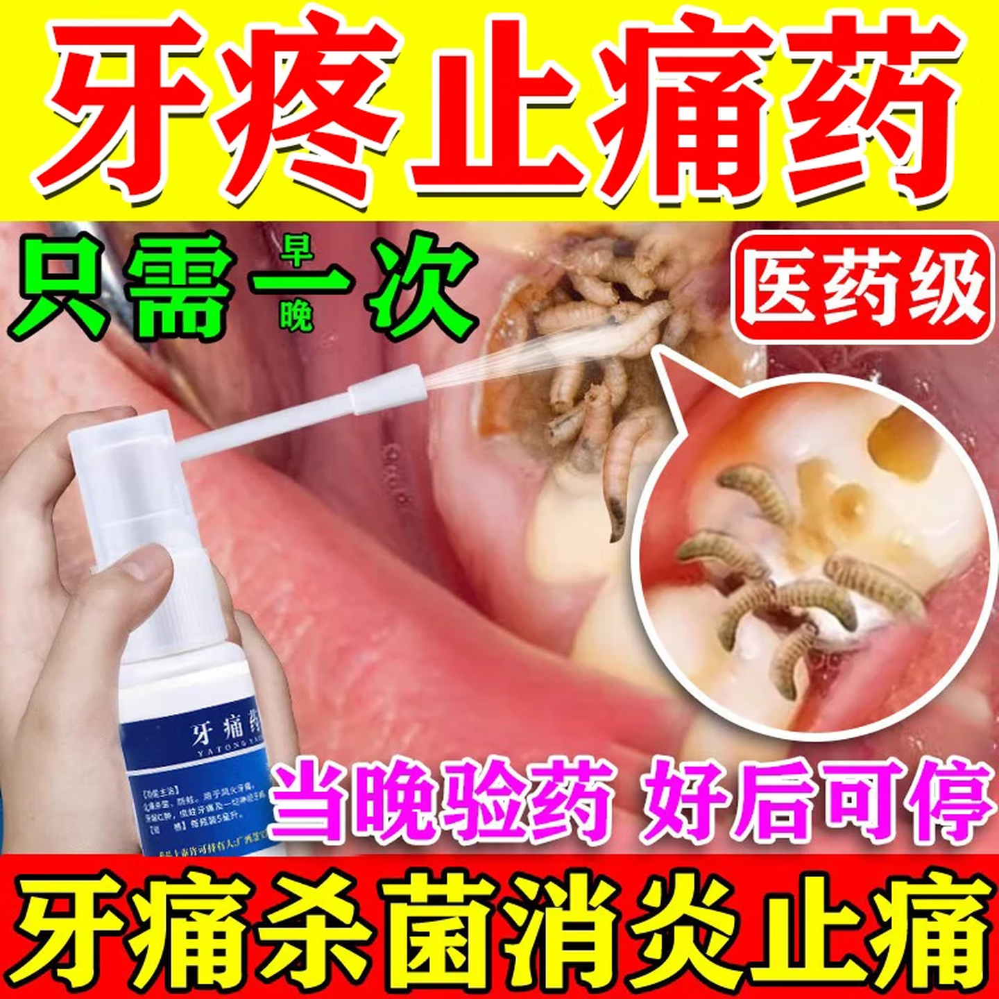 牙痛药水治疗牙疼速效止疼药杀神经牙龈肿痛消炎止痛喷雾蛀牙疼痛