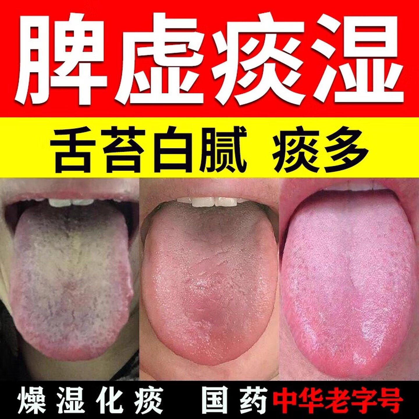 同仁堂二陈丸健脾化痰湿中成药半夏燥湿化痰调理脾胃痰湿热舌苔白